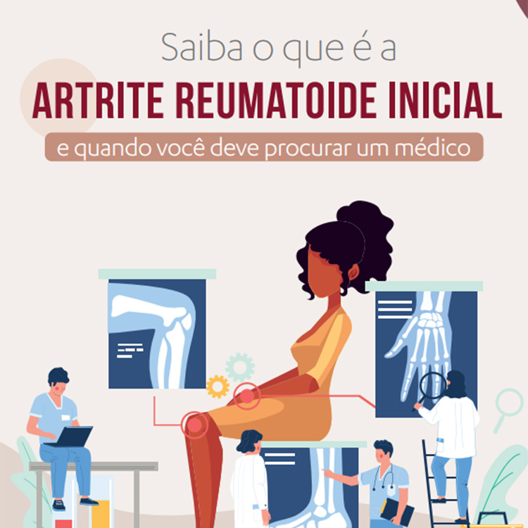 Leia mais sobre o artigo Saiba o que é a Artrite Reumatoide Inicial e quando você deve procurar um médico.