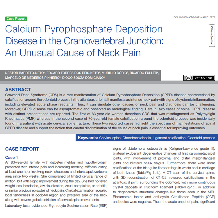 Leia mais sobre o artigo Calcium Pyrophosphate Deposition Disease in the Craniovertebral Junction: An Unusual Cause of Neck Pain